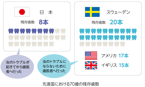 先進国における70歳の残存歯数(スウェーデン20本、アメリカ17本、イギリス15本に対して、日本は8本)